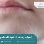 أسباب جفاف البشرة المفاجئ