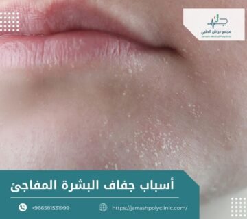 أسباب جفاف البشرة المفاجئ