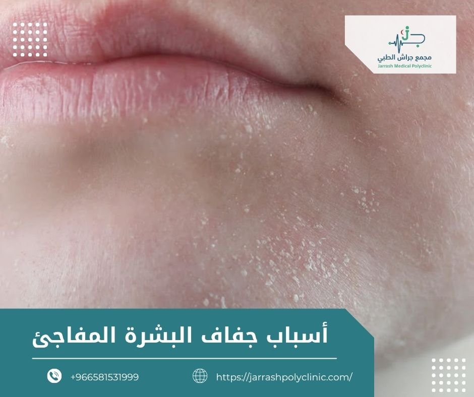 أسباب جفاف البشرة المفاجئ