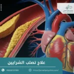 علاج تصلب الشرايين