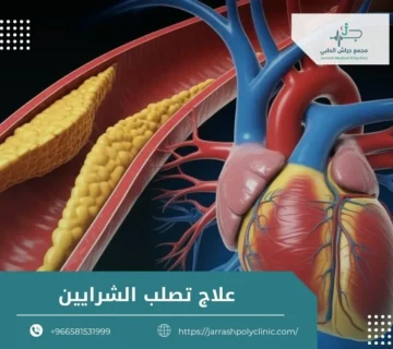 علاج تصلب الشرايين