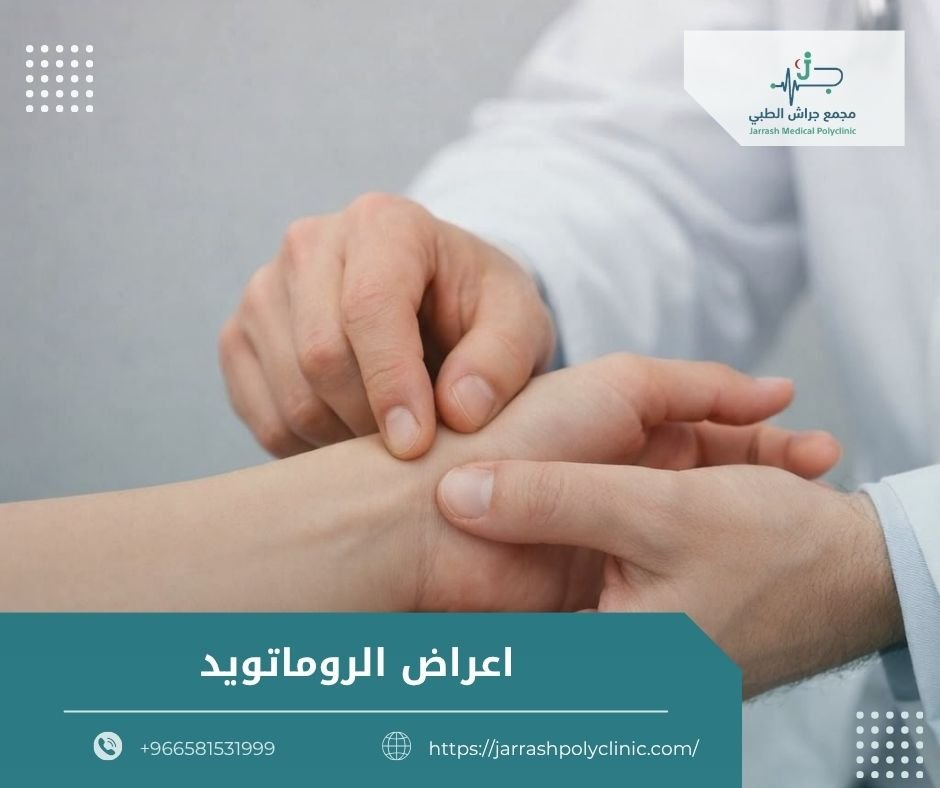 اعراض الروماتويد