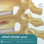 اعراض هشاشة العظام