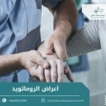 اعراض الروماتويد