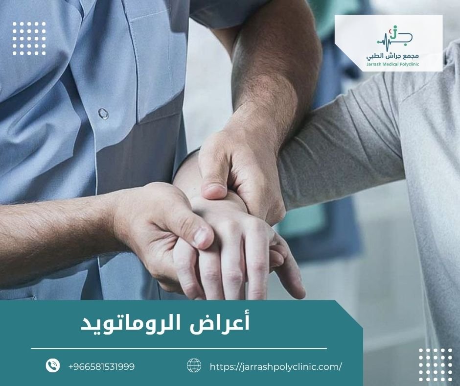 اعراض الروماتويد