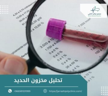 تحليل مخزون الحديد