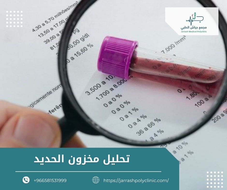 تحليل مخزون الحديد