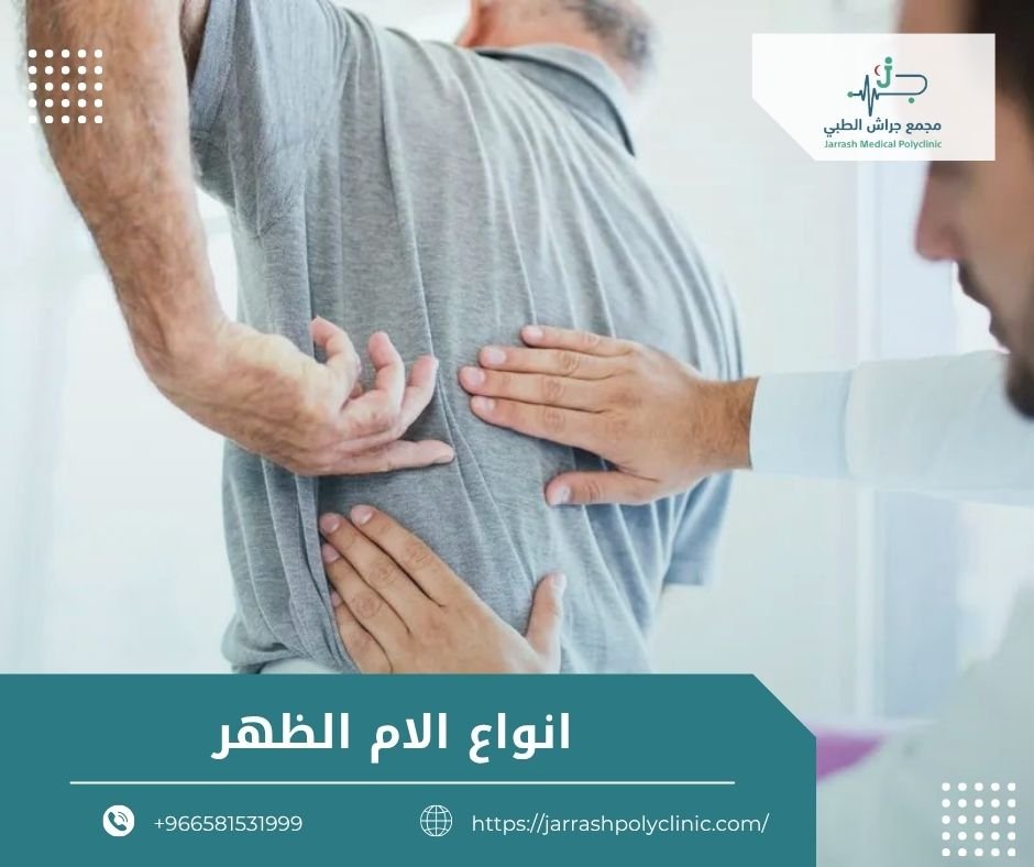 انواع الام الظهر