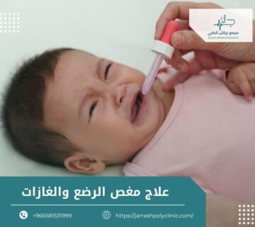 علاج مغص الرضع والغازات