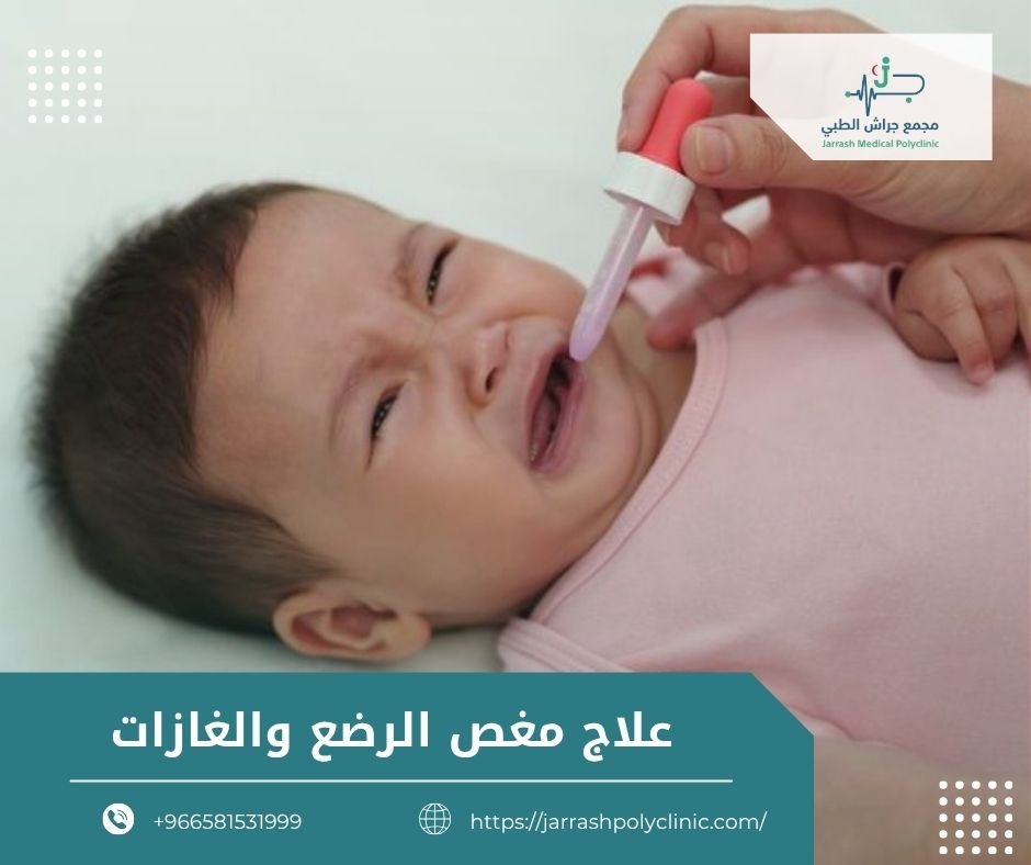 علاج مغص الرضع والغازات