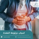 اسباب جرثومة المعدة