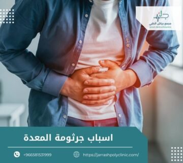 اسباب جرثومة المعدة