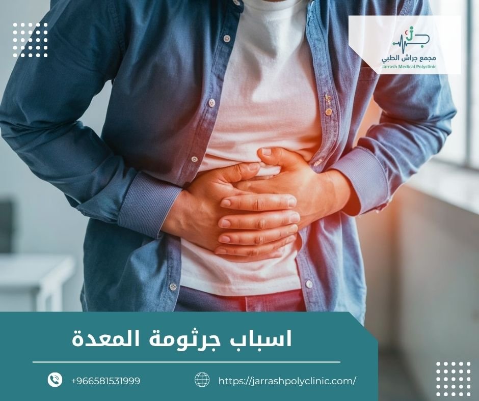 اسباب جرثومة المعدة