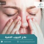 علاج الجيوب الانفية