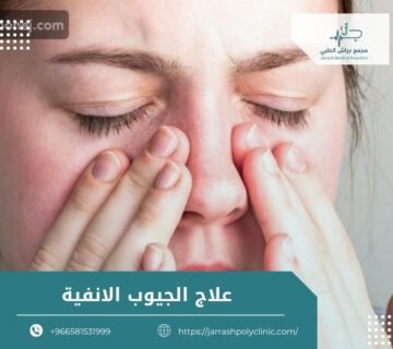 علاج الجيوب الانفية