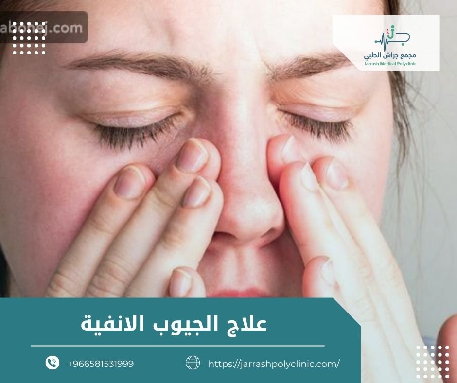 علاج الجيوب الانفية