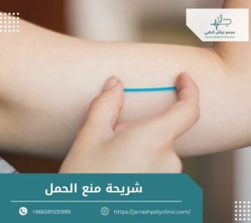 شريحة منع الحمل