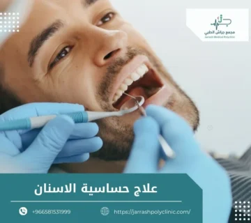 علاج حساسية الاسنان