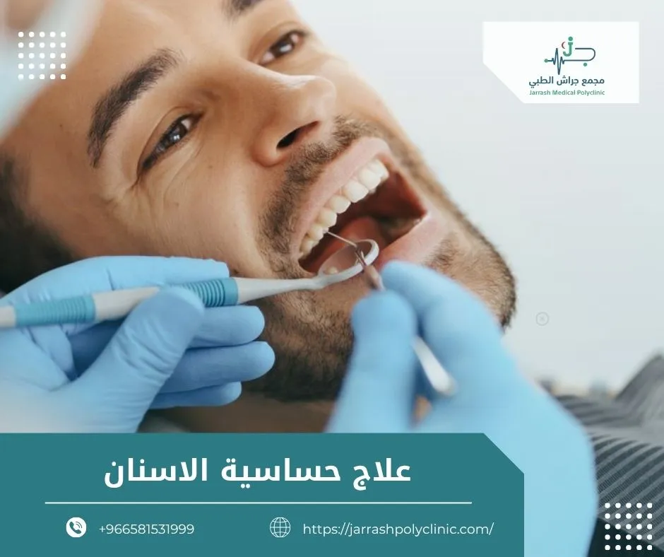 علاج حساسية الاسنان