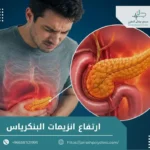 ارتفاع انزيمات البنكرياس