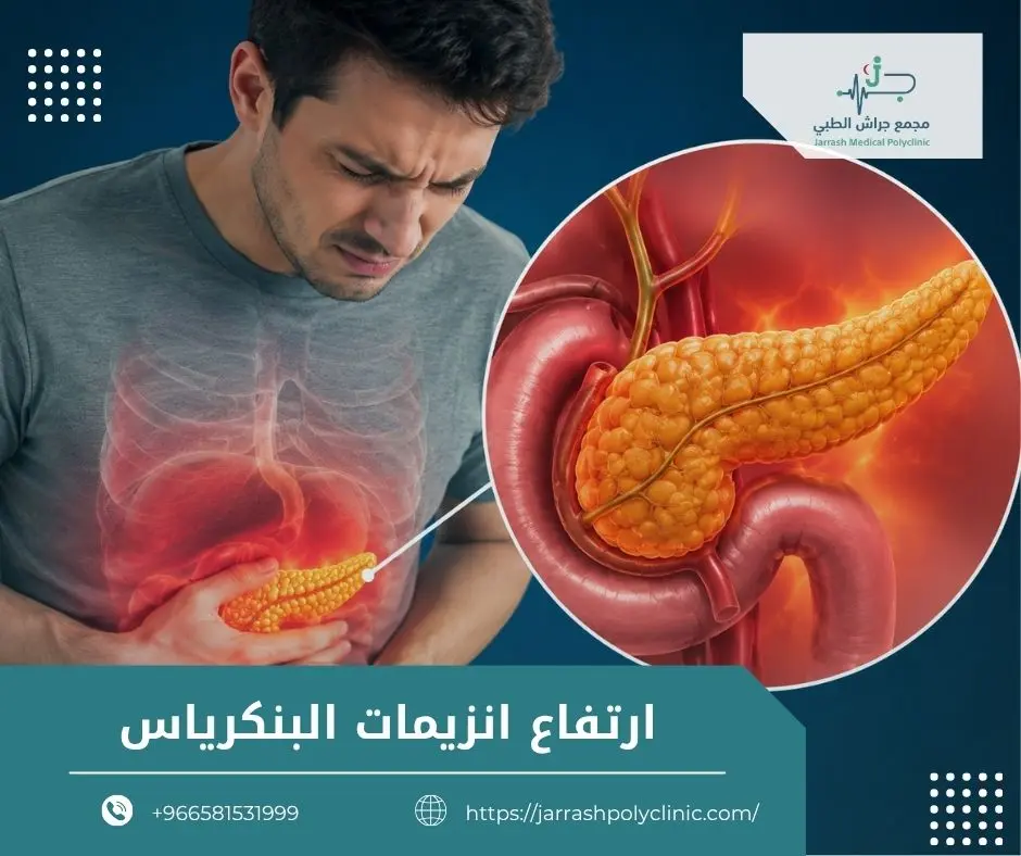 ارتفاع انزيمات البنكرياس