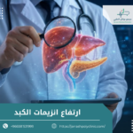 ارتفاع انزيمات الكبد