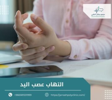 التهاب عصب اليد