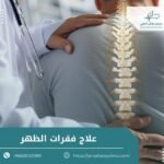 علاج فقرات الظهر