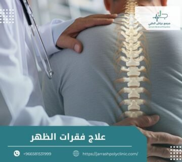علاج فقرات الظهر