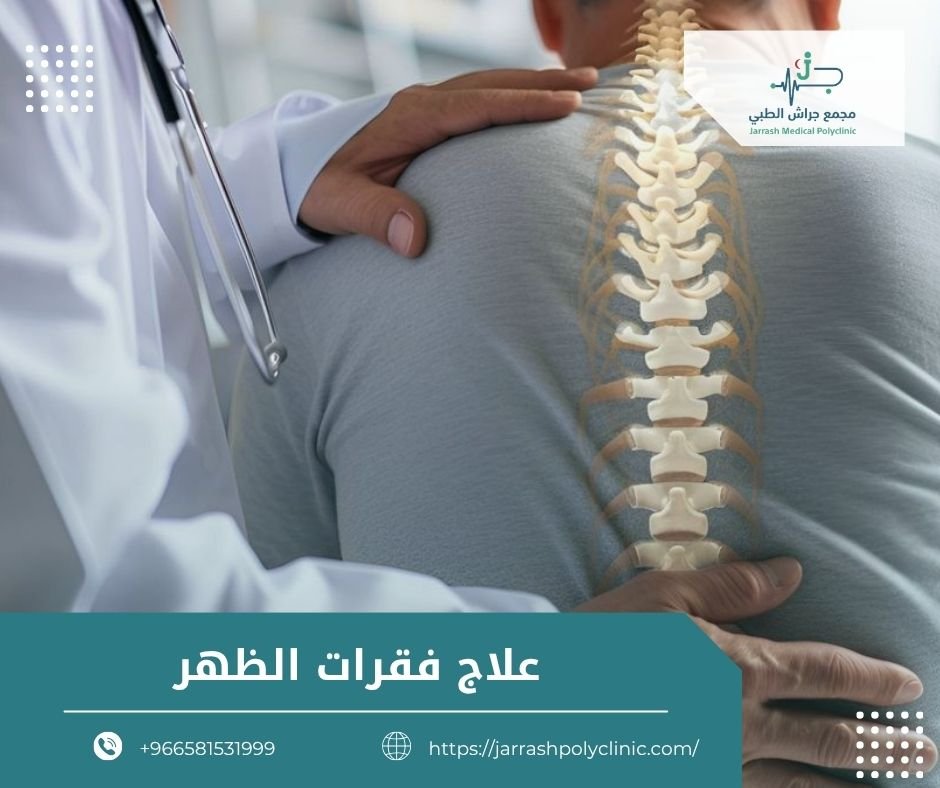 علاج فقرات الظهر
