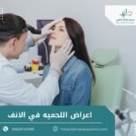 اعراض اللحمية في الانف