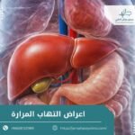 اعراض التهاب المرارة