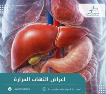اعراض التهاب المرارة