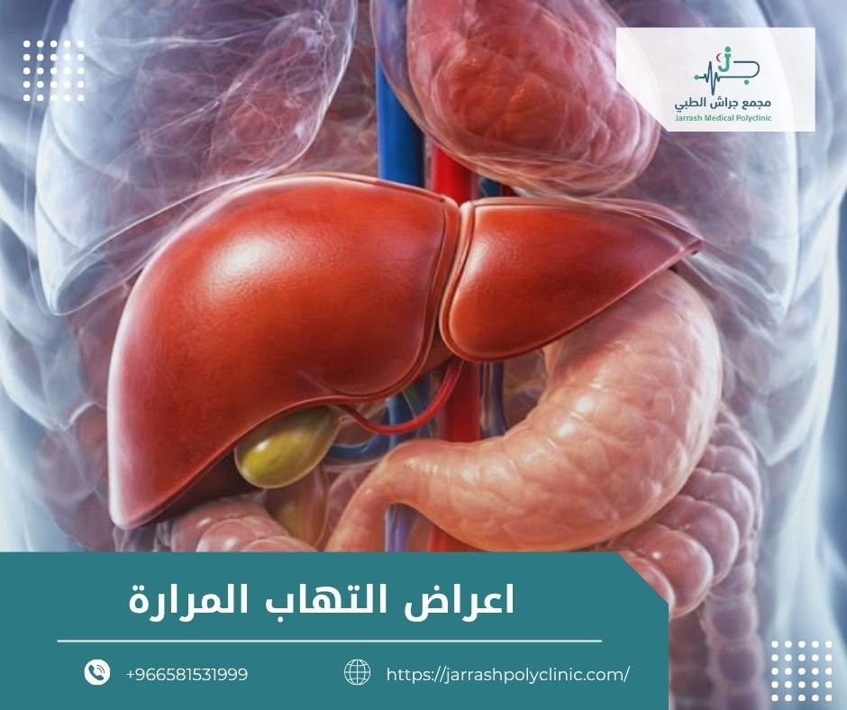 اعراض التهاب المرارة