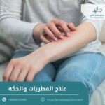 علاج الفطريات والحكة