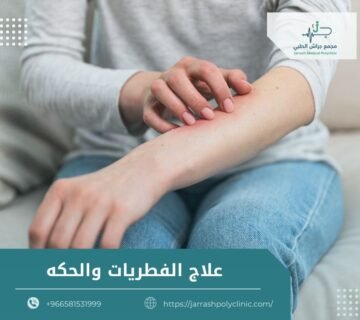 علاج الفطريات والحكة