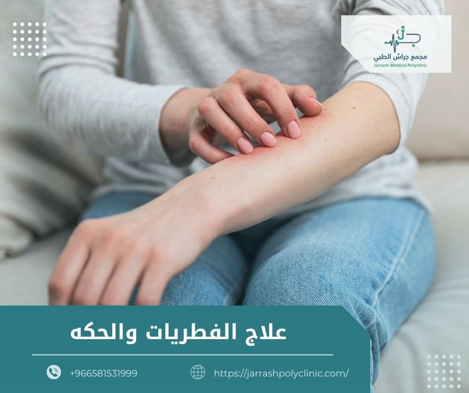 علاج الفطريات والحكة