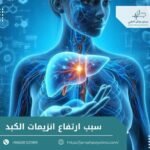 سبب ارتفاع انزيمات الكبد