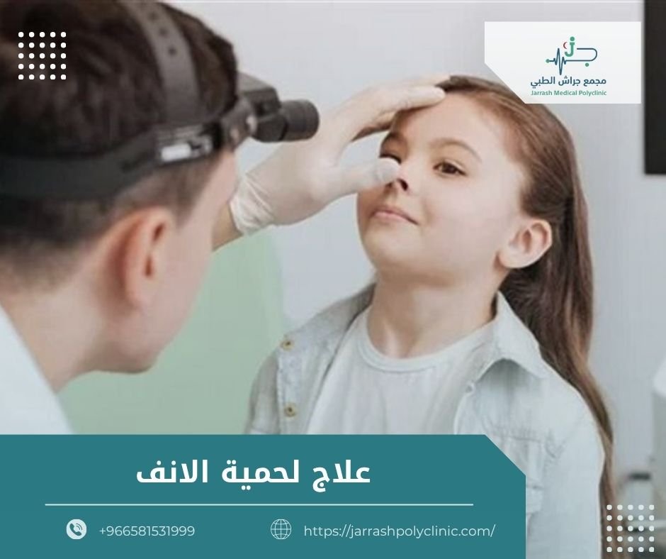 علاج لحمية الأنف