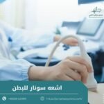 اشعه سونار للبطن