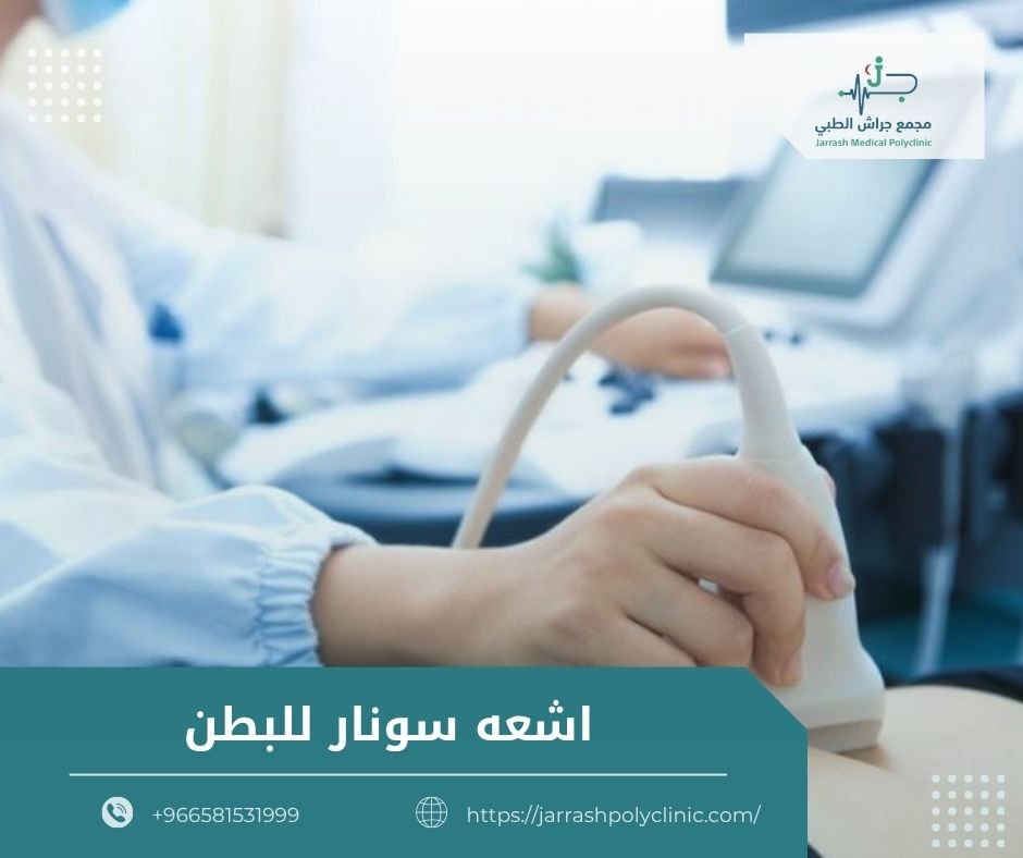 اشعه سونار للبطن