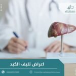 اعراض تليف الكبد