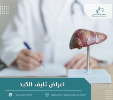 اعراض تليف الكبد