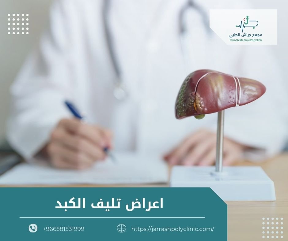 اعراض تليف الكبد