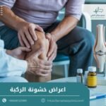 اعراض خشونة الركبة