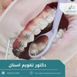 دكتور تقويم اسنان