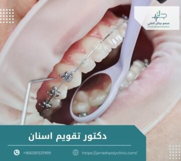 دكتور تقويم اسنان