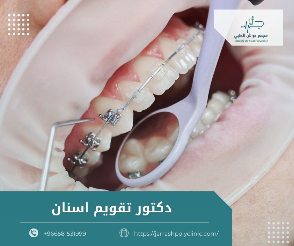 دكتور تقويم اسنان