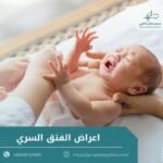 اعراض الفتق السري