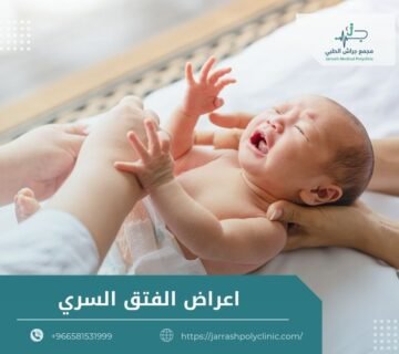 اعراض الفتق السري